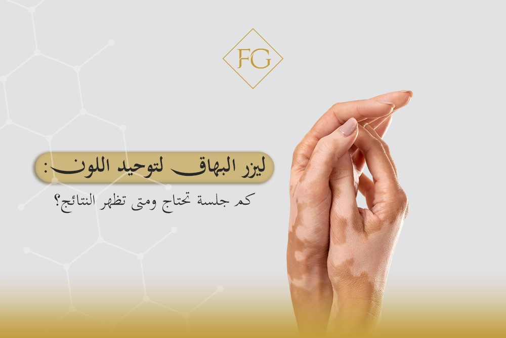 ليزر البهاق لتوحيد اللون