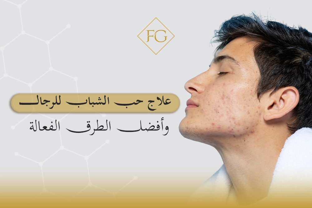 علاج حب الشباب للرجال