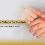 biggest trigger for psoriasis