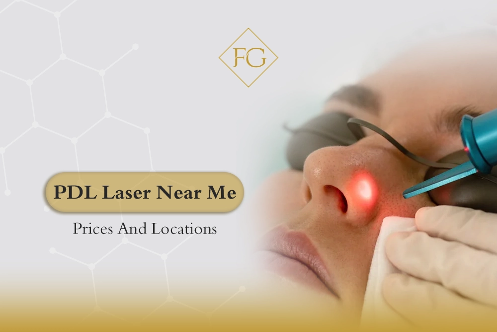 PDL laser near me