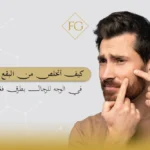 كيف أتخلص من البقع السوداء في الوجه للرجال