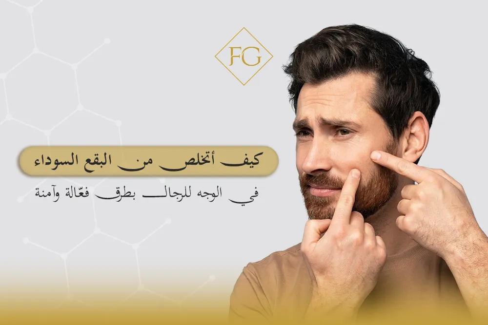 كيف أتخلص من البقع السوداء في الوجه للرجال