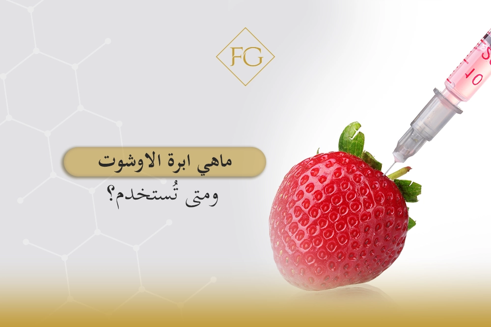 ماهي ابرة الاوشوت
