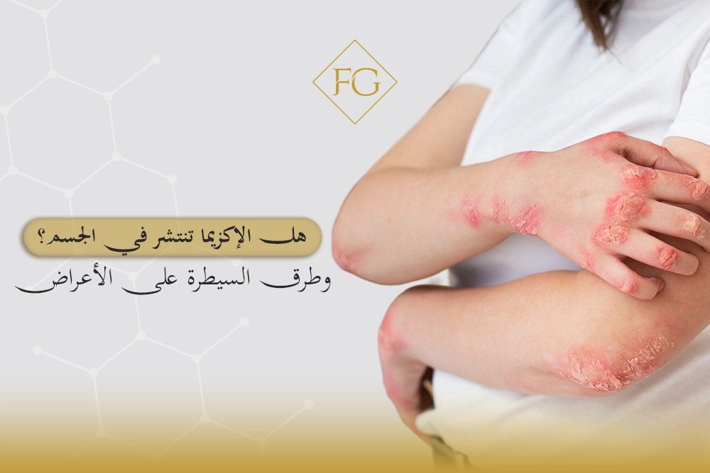 هل الإكزيما تنتشر في الجسم؟