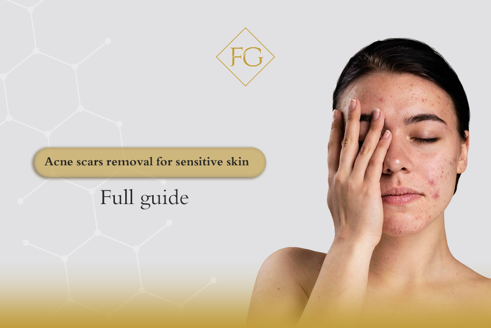 acne scars removal
