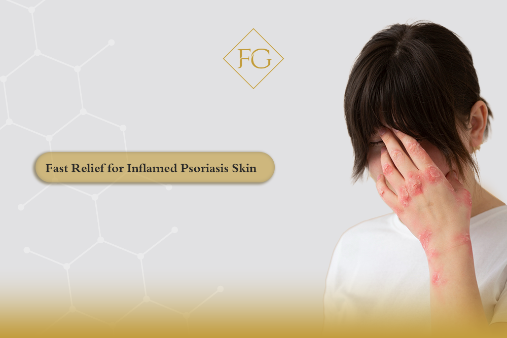 Inflamed Psoriasis Skin