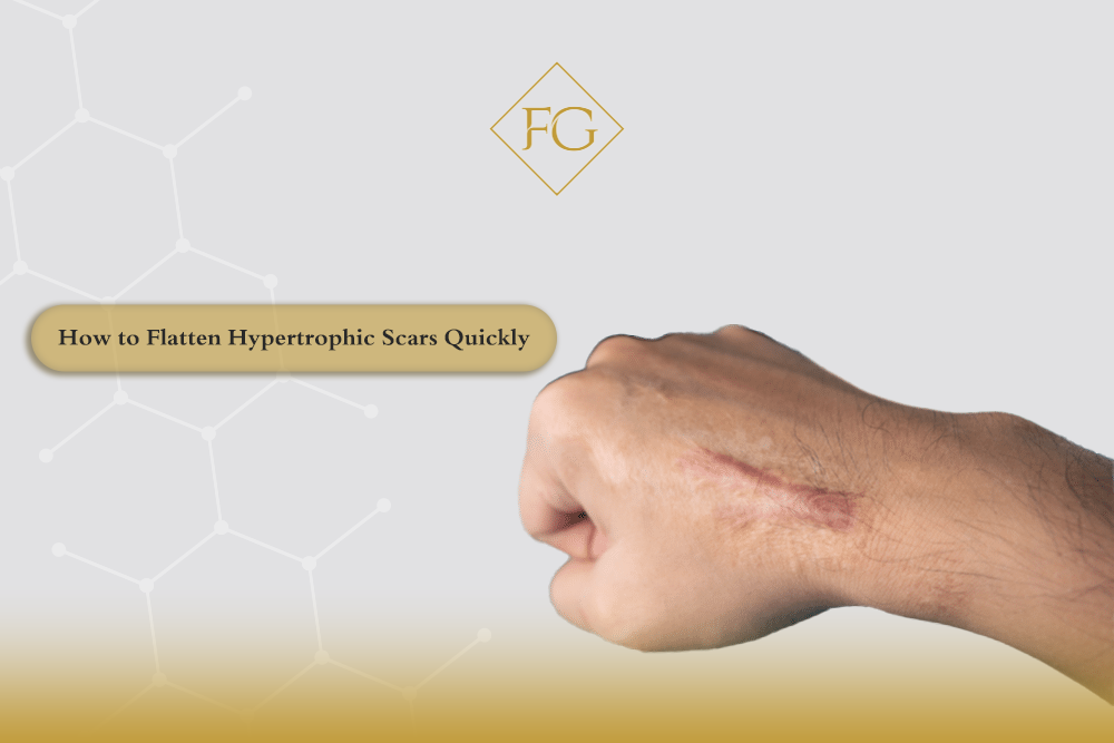 Flatten Hypertrophic Scars