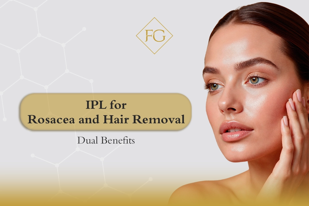 IPL for rosacea near me