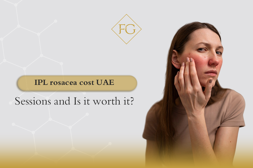 IPL rosacea cost UAE