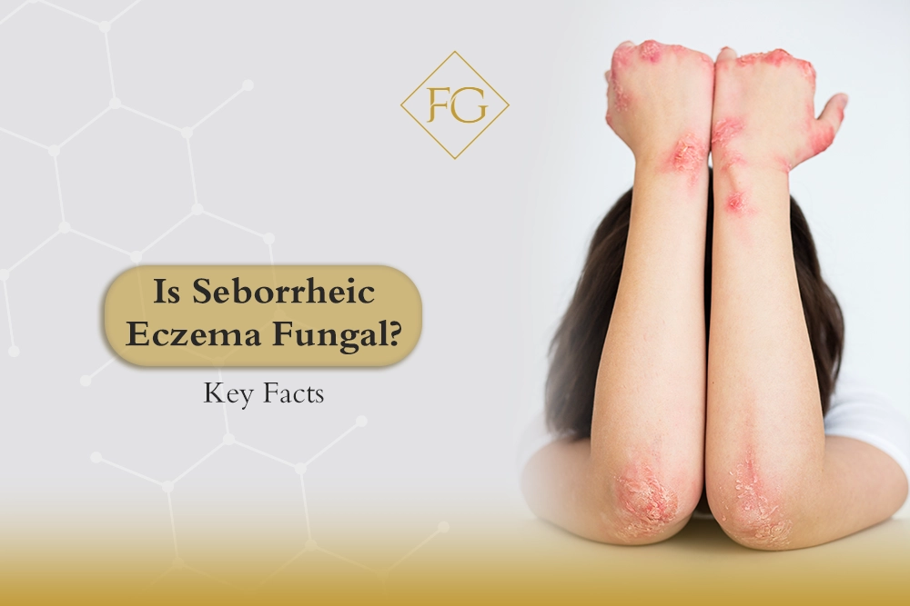Is Seborrheic Eczema Fungal