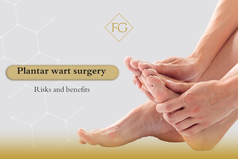 Plantar wart surgery