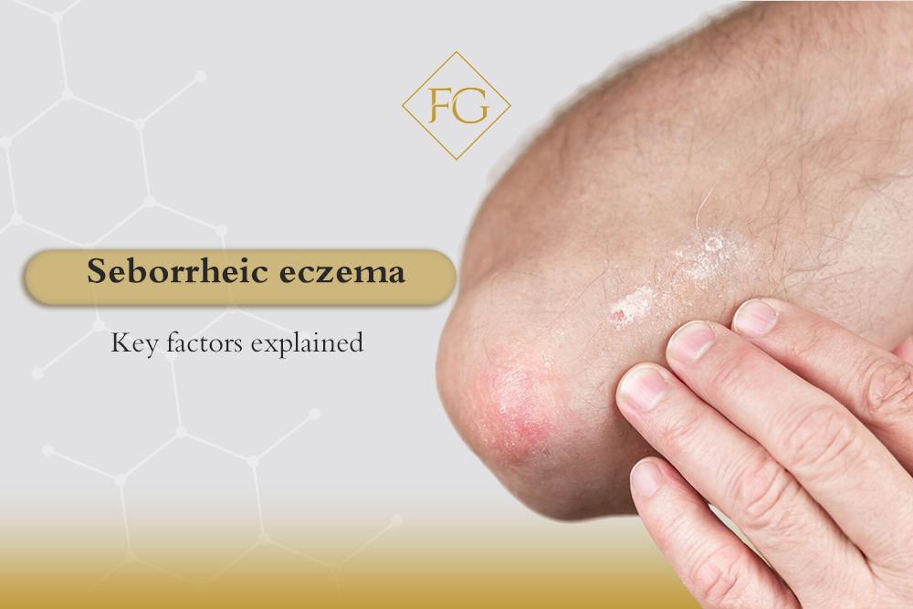 Seborrheic eczema