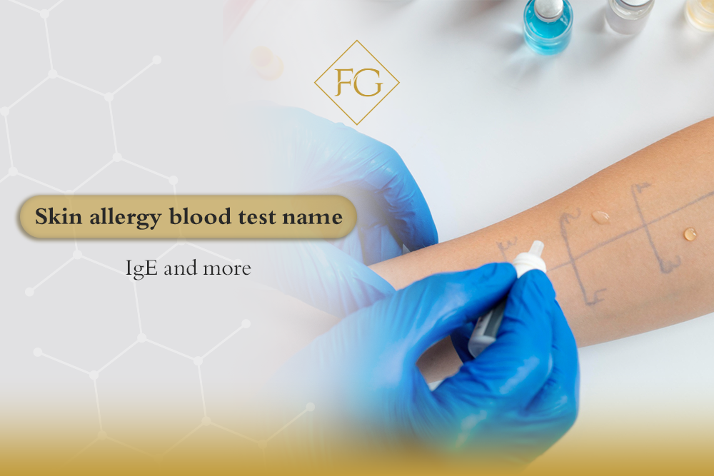 Skin allergy blood test name
