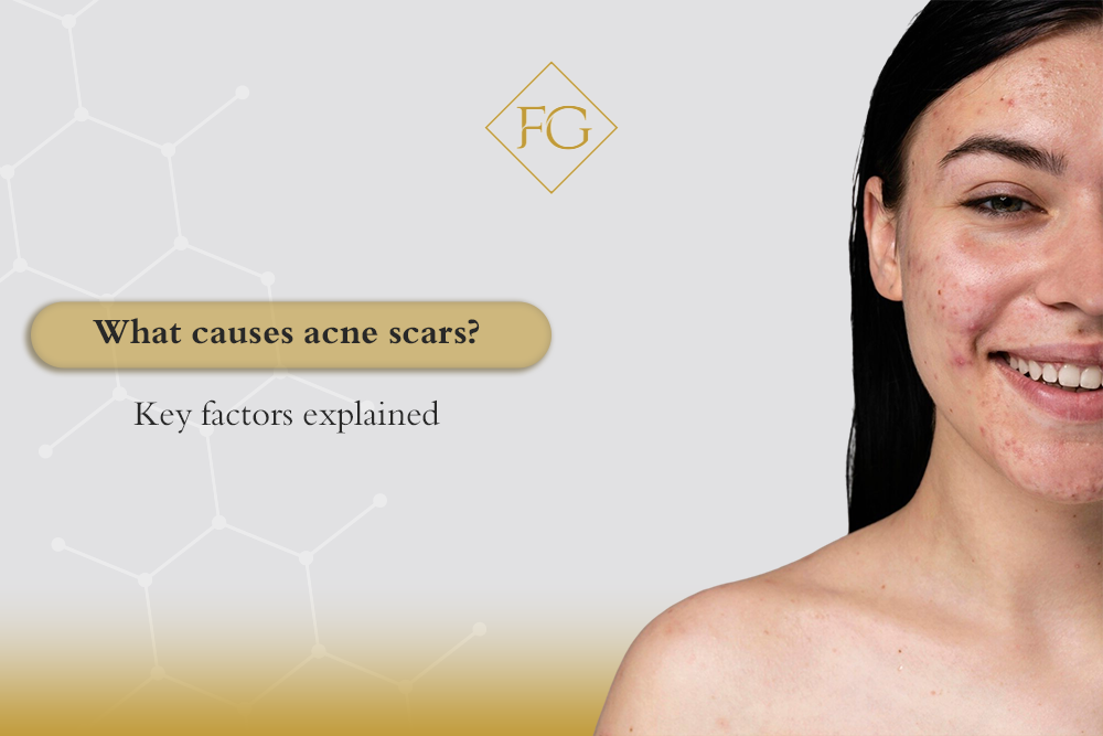 What causes acne scars