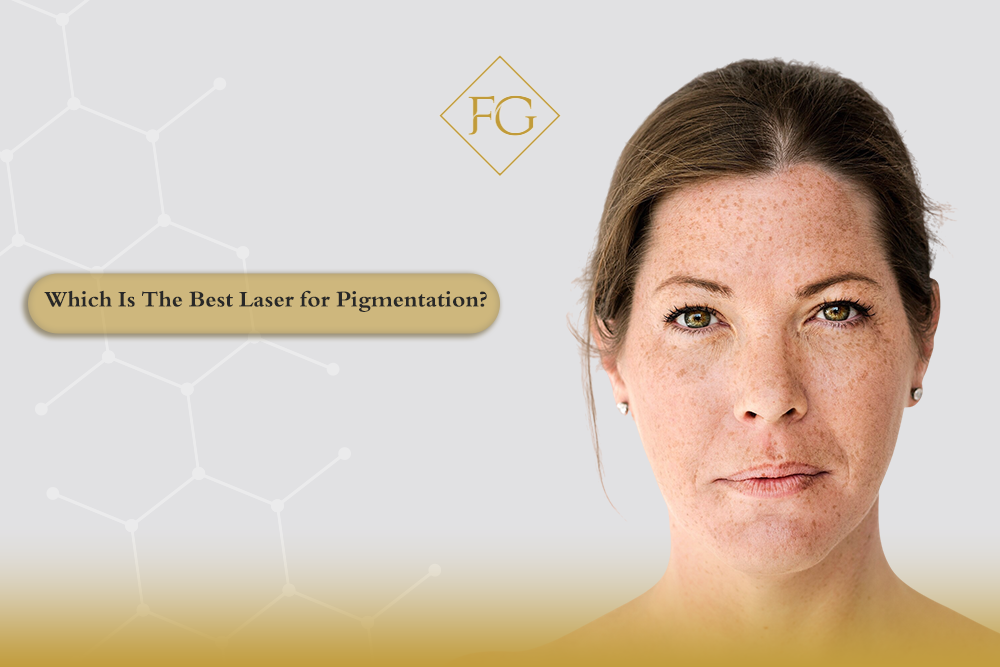 best laser for pigmentation