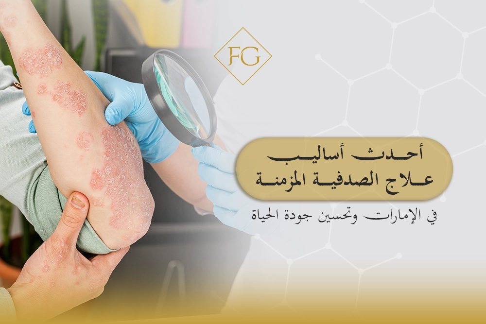 علاج الصدفية المزمنة في الإمارات