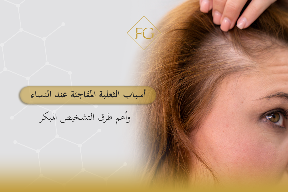 أسباب الثعلبة المفاجئة عند النساء