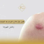 علاج الجدرات بعد العمليات الجراحية