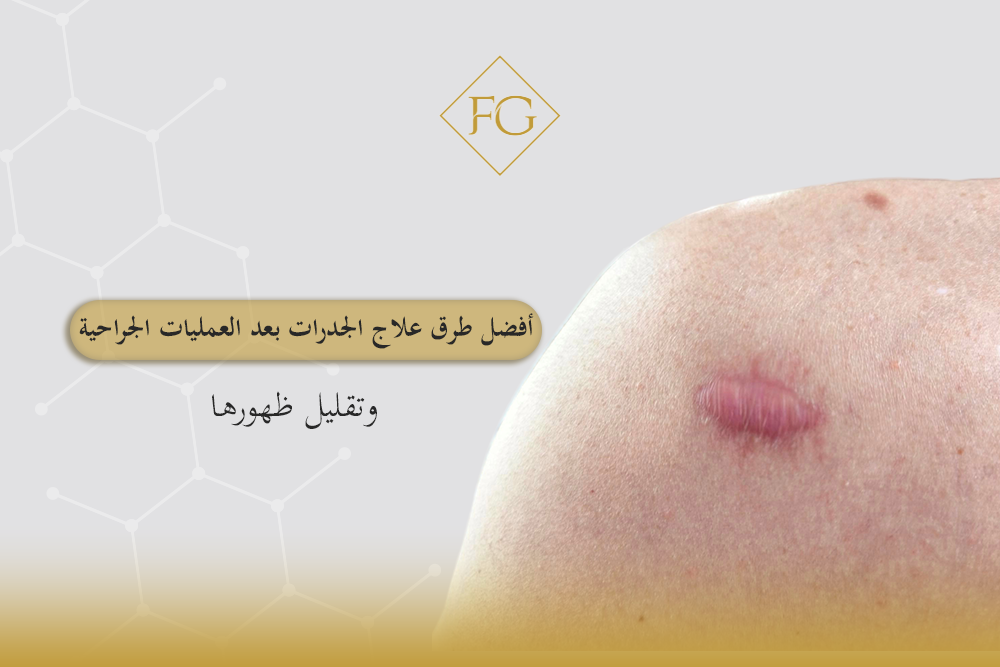 علاج الجدرات بعد العمليات الجراحية
