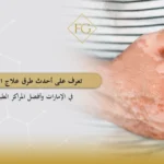 أحدث طرق علاج البهاق