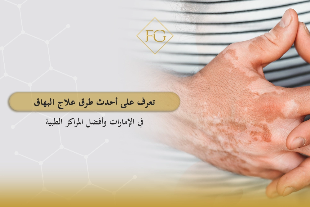 أحدث طرق علاج البهاق