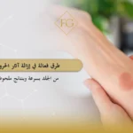 إزالة آثار الحروق من الجلد بسرعة
