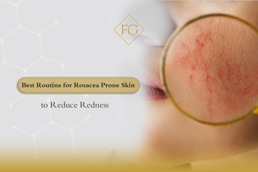 routine for rosacea prone skin