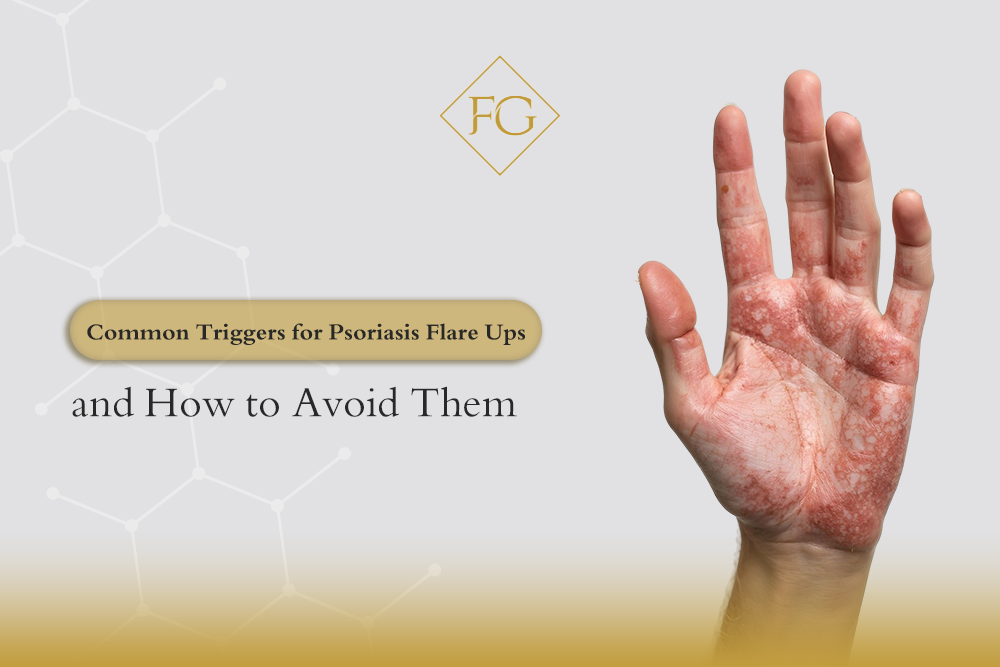 triggers psoriasis flare ups