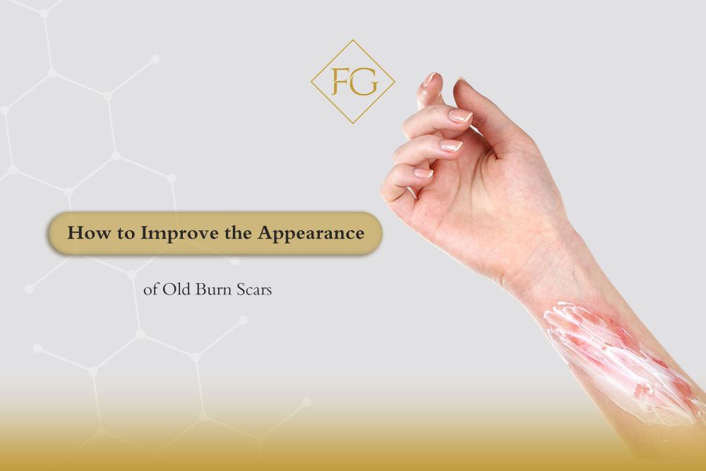 old burn scars