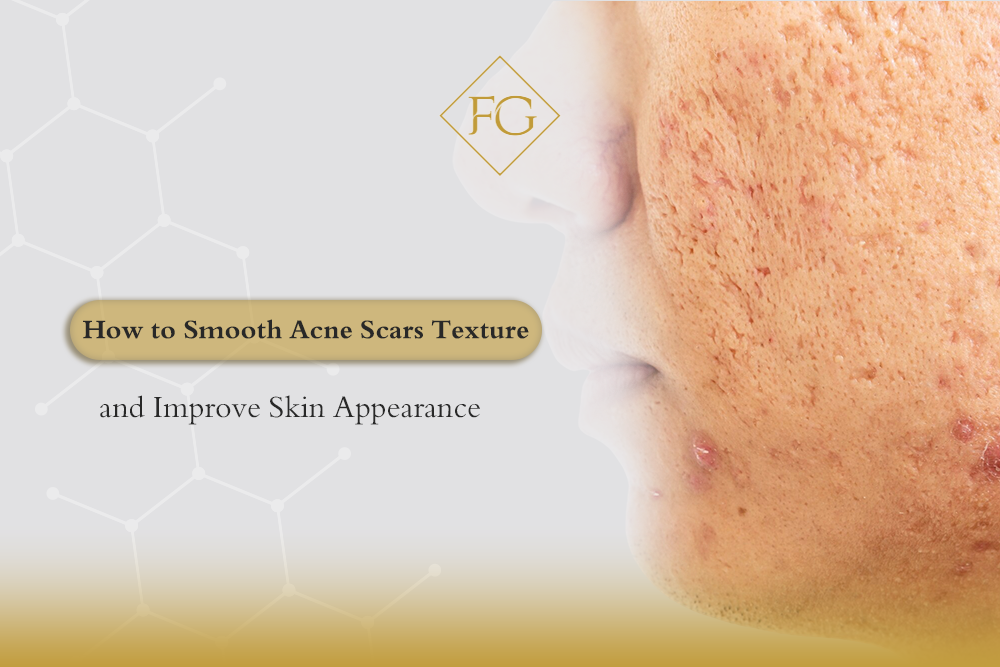 smooth acne scars texture