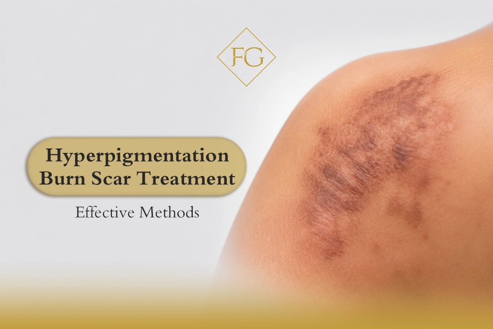 Hyperpigmentation burn scar treatment