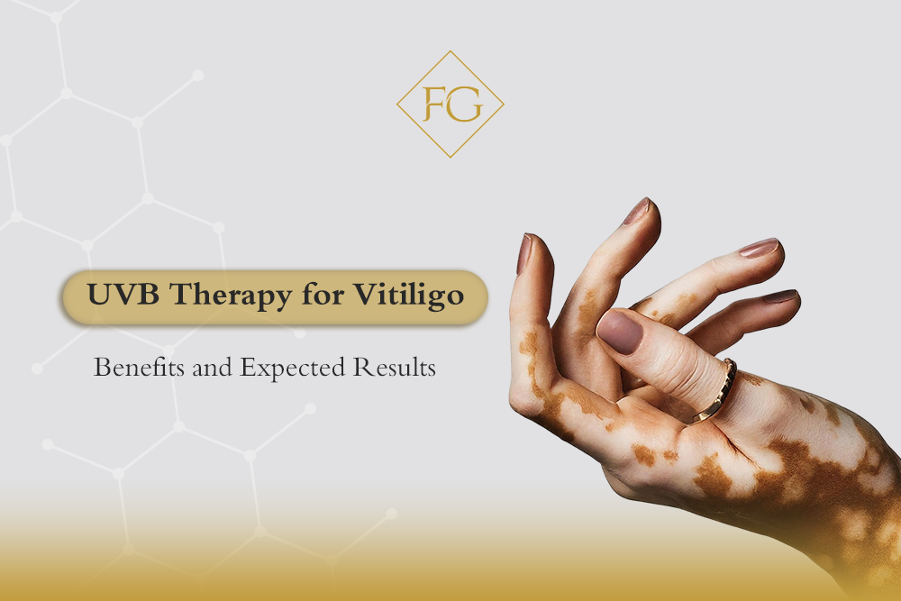 uvb therapy for vitiligo