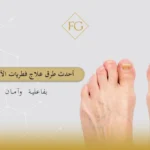 طرق علاج فطريات الأظافر
