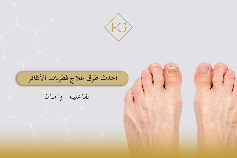 طرق علاج فطريات الأظافر
