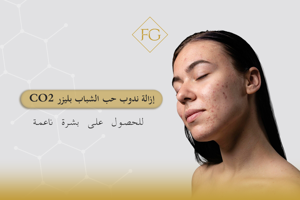 إزالة ندوب حب الشباب بليزر CO2
