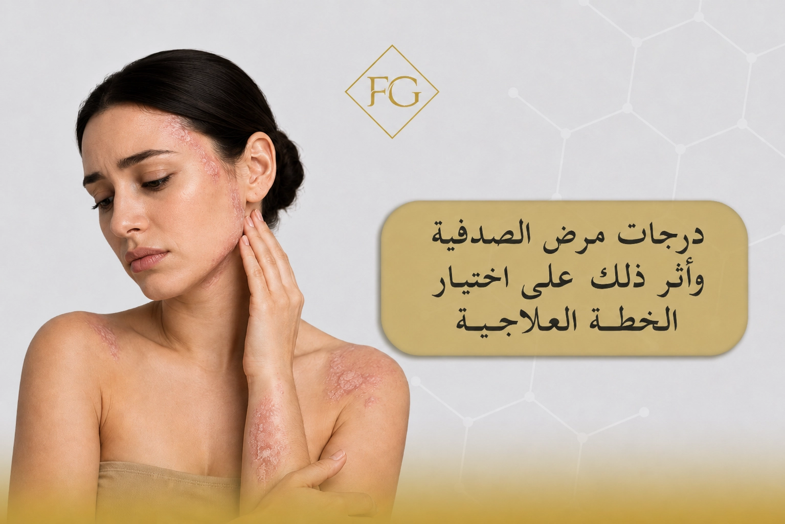 درجات مرض الصدفية