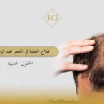 علاج الثعلبة في الشعر عند الرجال