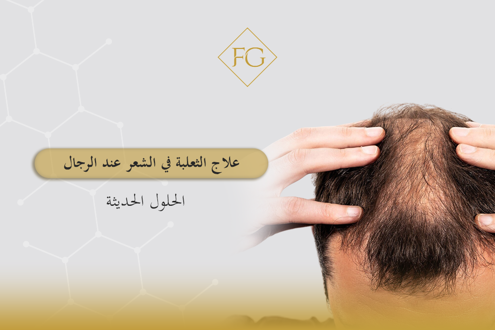 علاج الثعلبة في الشعر عند الرجال