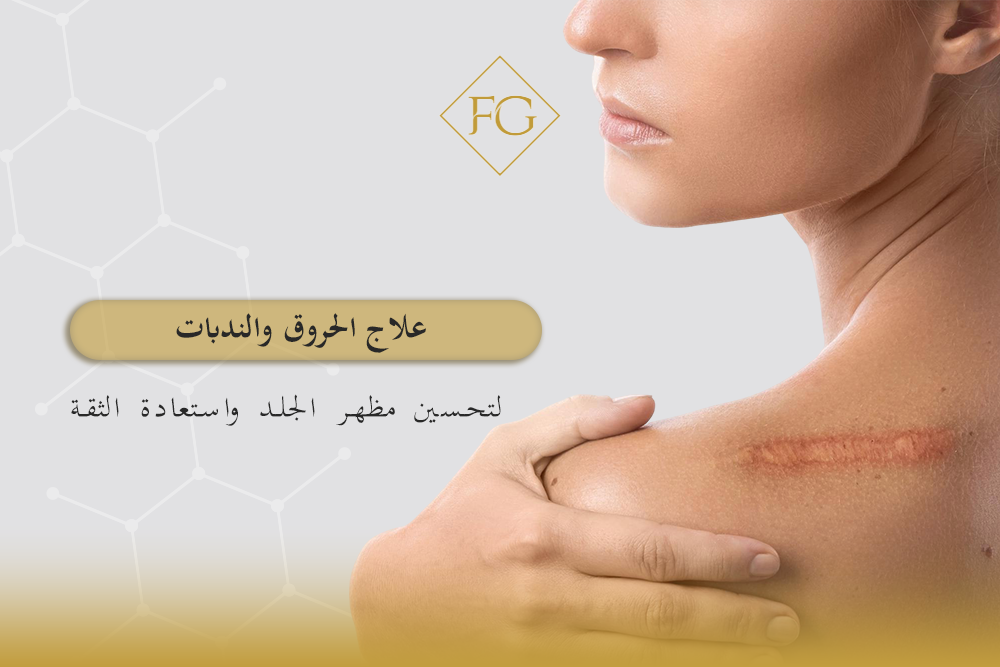 علاج الحروق والندبات